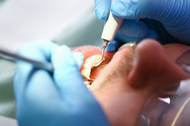 Best Emergency Care for Gum Disease in Fox Chapel, PA